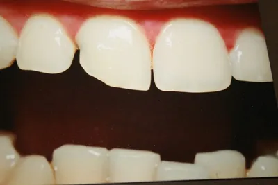 teeth_pics_010.JPG