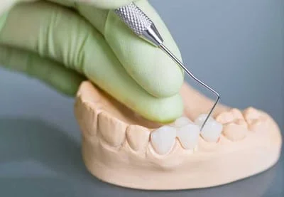 Teeth Options