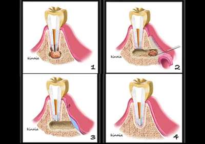 dental implants rochester mi