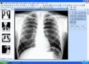 x-ray