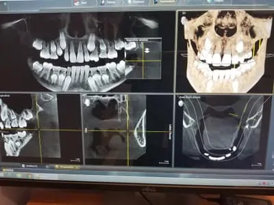Surgery Dental Imaging 2