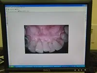 computer screen showing intraoral pictures of mouth, dentist Mahwah, NJ 