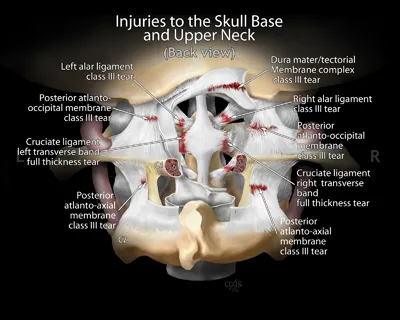 Injury Skull