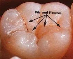 Sealants___1.jpg