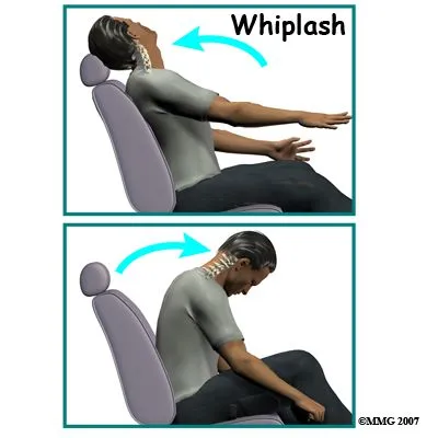 Whiplash Injury Bozeman, MT