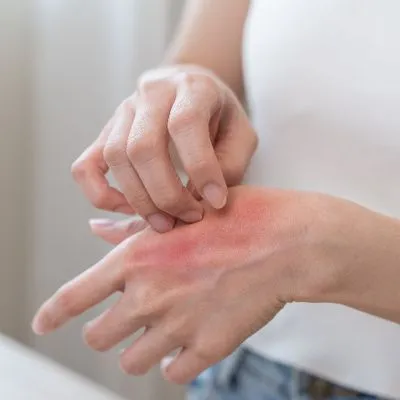 Clinical Studies for Psoriasis