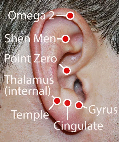 Battlefield Acupuncture