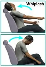 What happens to your neck during a Whiplash