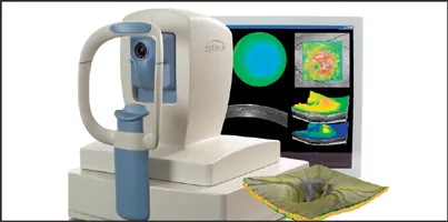 Heidelburg Retina Tomograph III 2