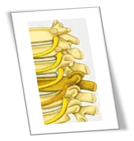 spinal_disc_2.png