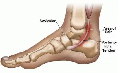 medial ankle ligaments