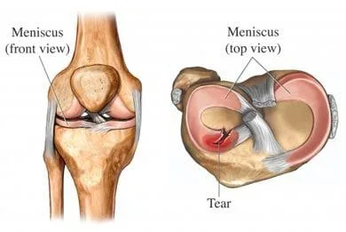 knee_meniscus_normal_v2.jpg