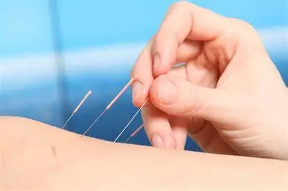 Needling