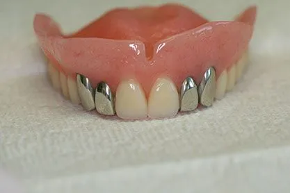 customdenture