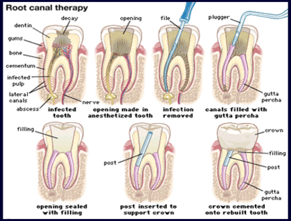 I'On Family Dentistry in Mount Pleasant SC