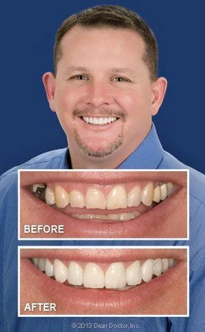 Smile Makeover Niceville, FL cosmetic dentistry