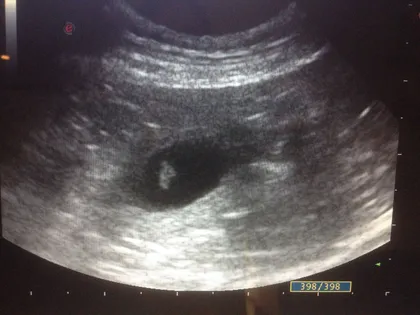 how accurate is a dog ultrasound