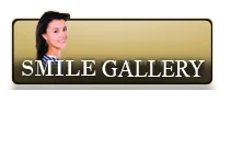 smile gallery