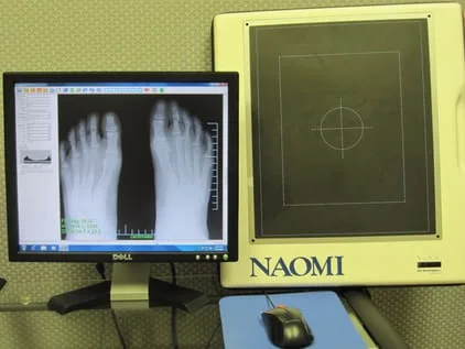  Naomi Direct Digital X-ray