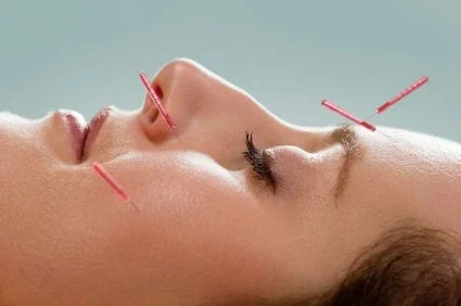Facial Rejuvenation acupuncture