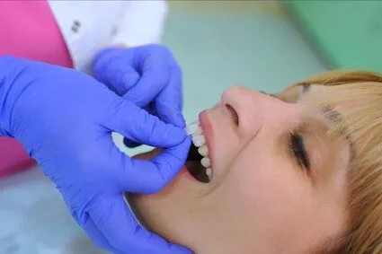 dentist's gloved hand placing veneer pieces onto woman's front teeth, cosmetic dentistry Sherman Oaks, CA veneers 