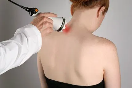 Neck-Treatment