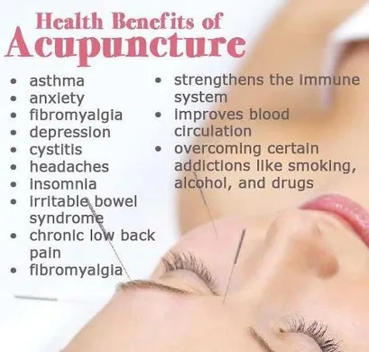 Acupuncture