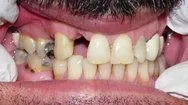 before cosmetic dentistry