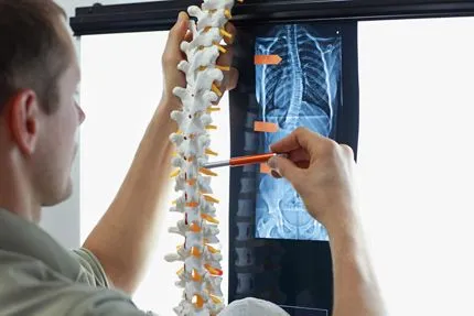 Doctor looking at spine xray