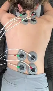 electrical stimuation on patient's back