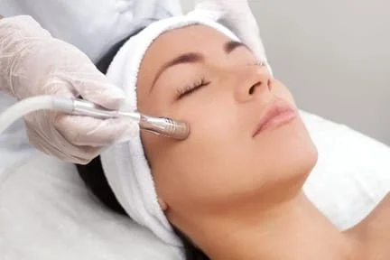 Microdermabrasion and Acne Treatment in Richmond Hill, ON