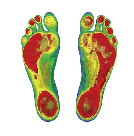 Colored Soles of Feet Showing a the Distribution of Weight on the Soles of the Feet