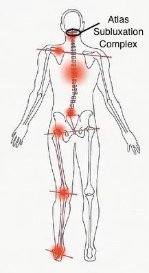 Fibromyalgia Treatment in Rochester, NY