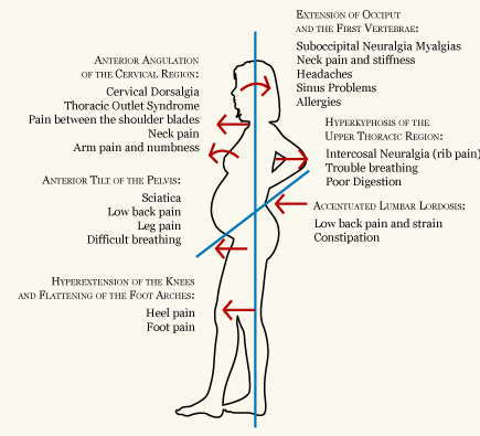 Back pain in pregnancy