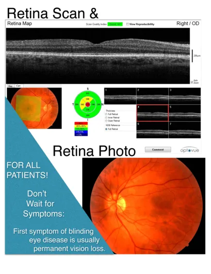 retina scan