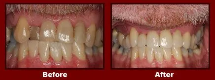 Cosmetic Reconstruction