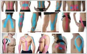 Kinesio Tape Treatment, KT Tape