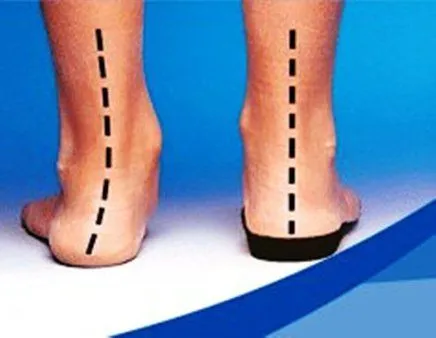 San Diego Podiatrist | San Diego Custom Made Orthotics | CA | San Diego Podiatry Group |