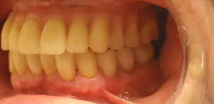 smile