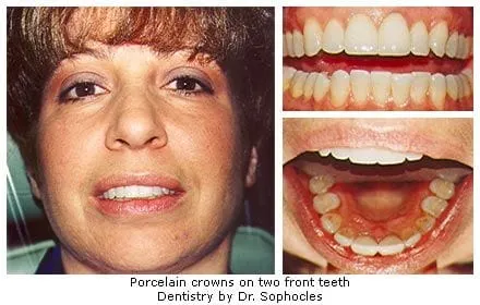 Cosmetic Dentistry by Dr. Dean Sophocles