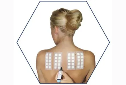 Allergic Patch Testing