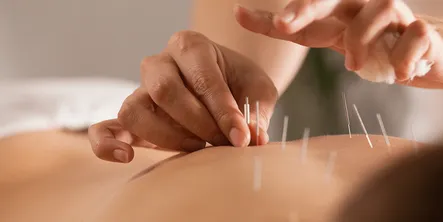 inserting needles