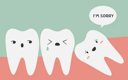 Wisdom Teeth Removal | Dentist In Greenville, NC | Southern Smiles of Eastern North Carolina