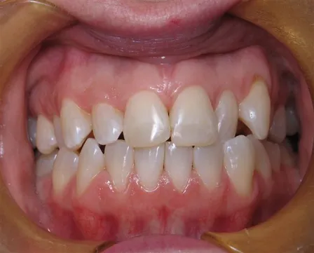 Noreen before-closeup