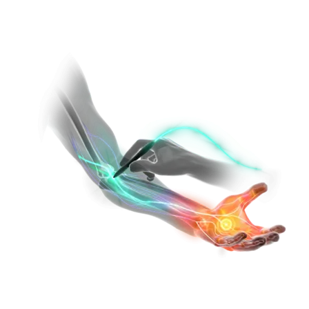 Stimpod treatment of Median Nerve