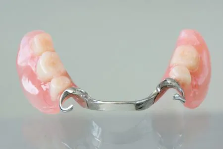 photo of a partial denture