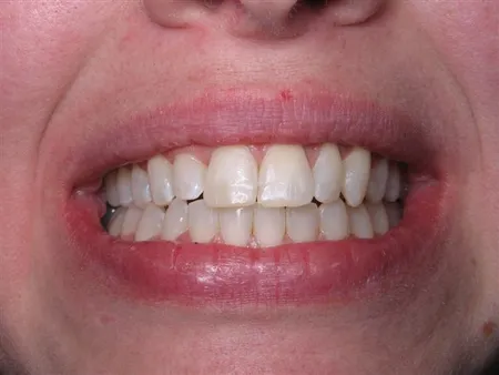 Noreen Finished-closeup