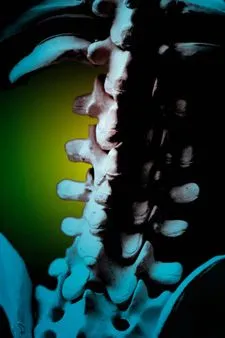 Spine model