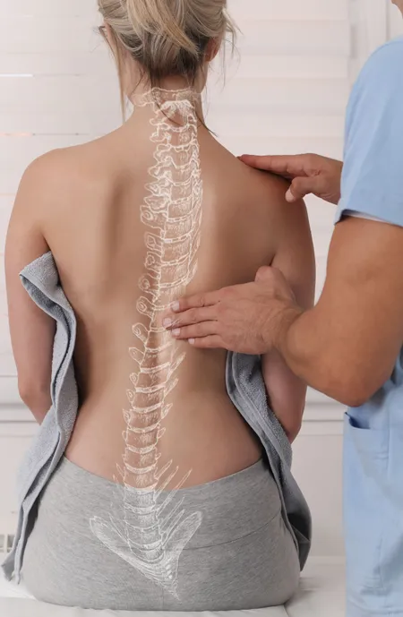 scoliosis