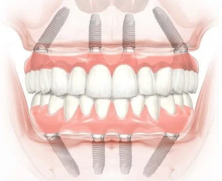 Denmark #4 Used WDWPhilatelic (4-23)2 - AbuMaizar Dental Roots Clinic